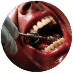 Essbares Papier Patient beim Zahnarzt 19,5 cm